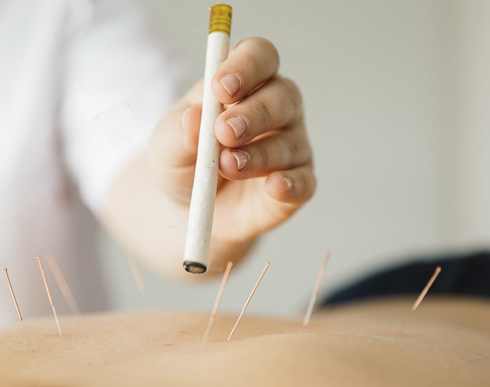 INT Acupunture2