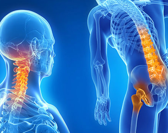 INT Mioterapia